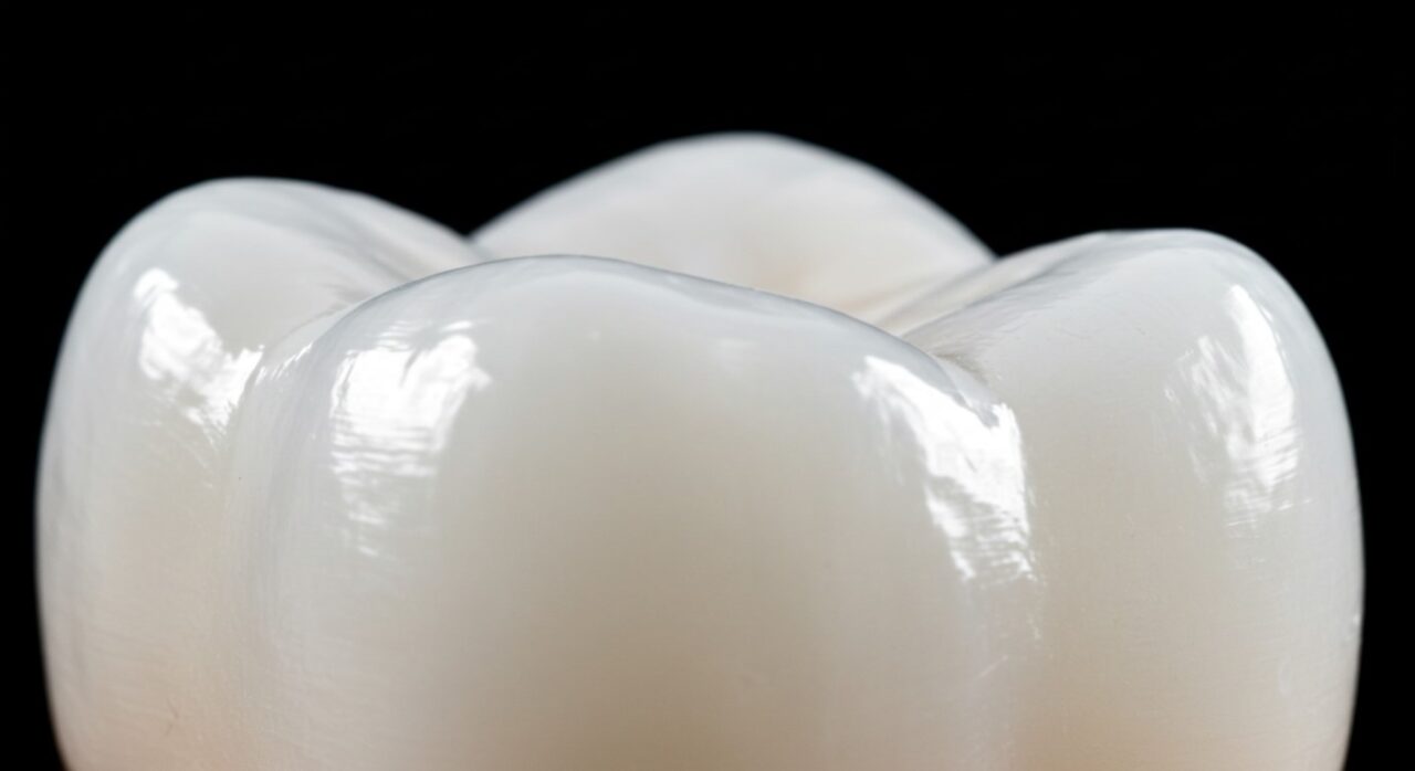 What is Composite Bonding